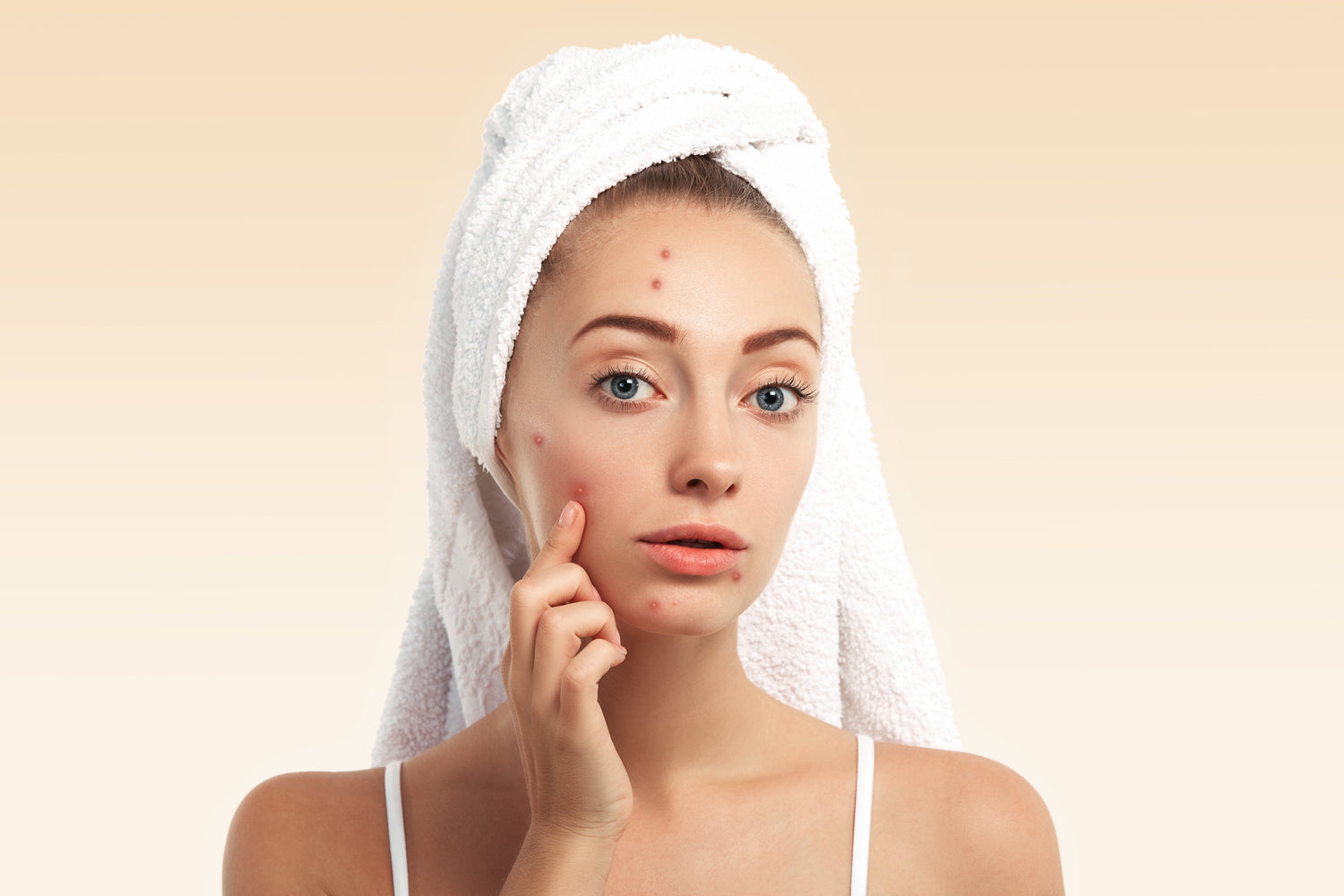 “Natural neem soap for pimple-free clear skin”  Herbal kuppaimeni soap for acne and oil control”  “Charcoal soap for deep cleansing and acne care”   “Multani mitti soap for oil balance and acne-prone skin”