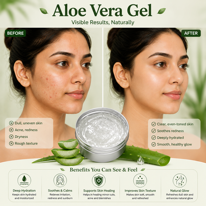 Aloe Vera Gel